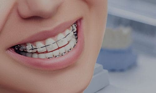 Orthodontics
