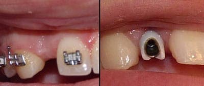 Before - Before treatment