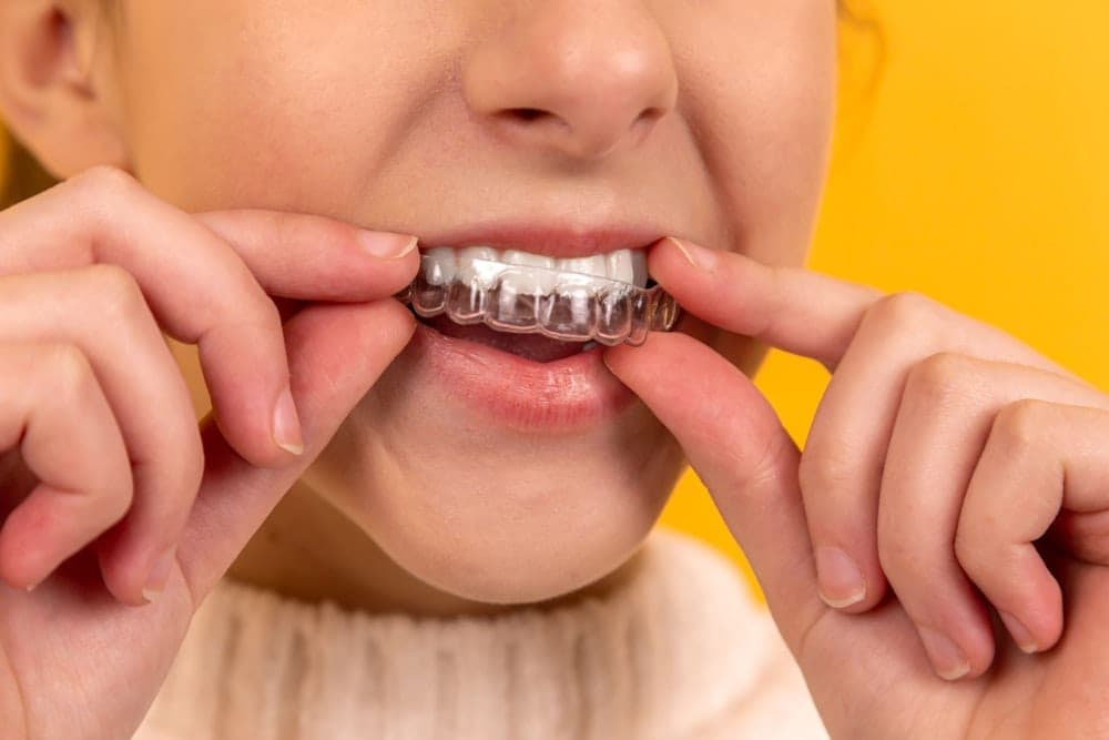 Root canal therapy procedure
