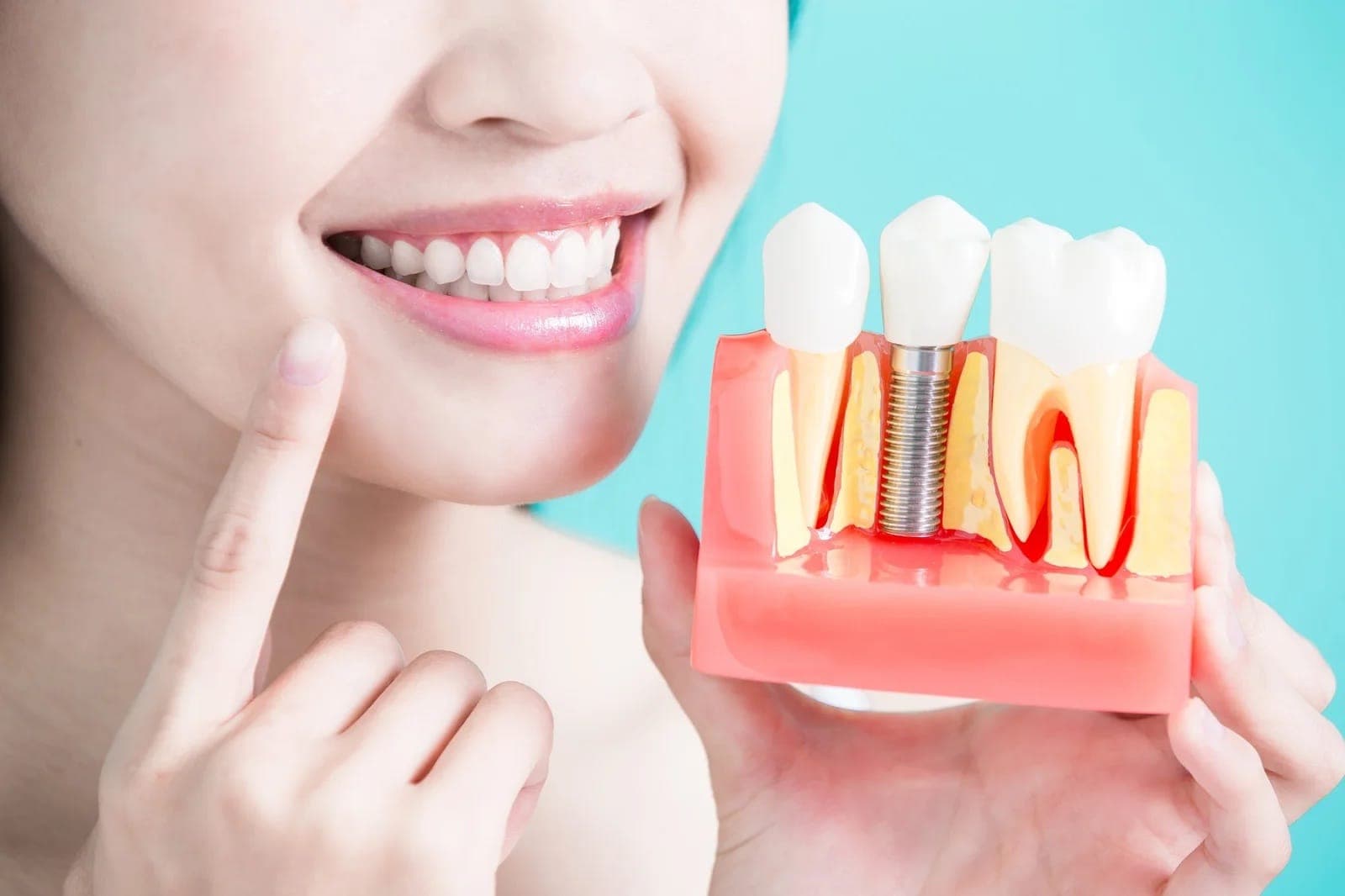 Dental implant post-operative care